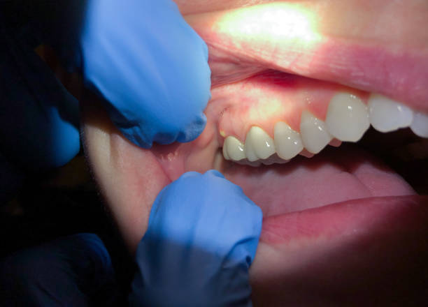 Best Root Canal Emergency Dentist  in Baxter Estates, NY